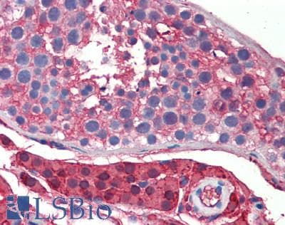IHC-plus™ GSTA3 Antibody