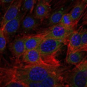 FGG / Fibrinogen Gamma Antibody (clone 4H9)
