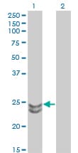RAB27A / RAB27 Antibody (clone 1G7)