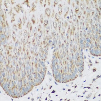 IMP-3 / IGF2BP3 Antibody