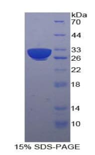 Human HSPA9 / Mortalin / GRP75 Protein (Recombinant His-T7)