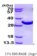Human BPGM Protein (Recombinant His)