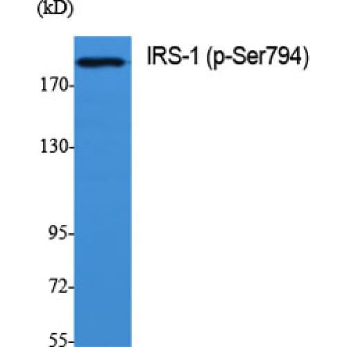 Polyclonal Rabbit anti-Human IRS1 Antibody (730-810 aa, IHC, IF, WB)