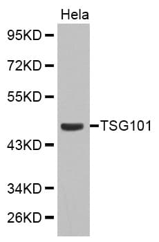 IHC-plus™ TSG101 Antibody
