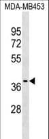Polyclonal Rabbit anti-Human P2RX3 / P2X3 Antibody (aa330-356, WB)