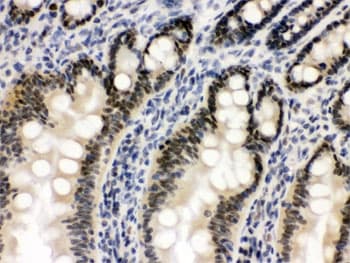 Polyclonal Rabbit anti-Human OGT / O-GLCNAC Antibody (IHC, WB)