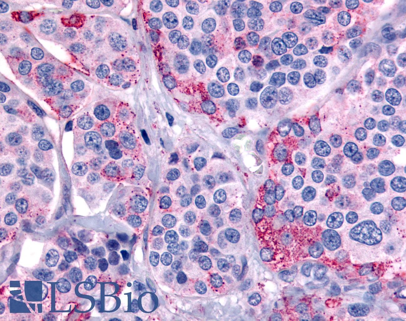 PathPlus™ CALCR / Calcitonin Receptor Antibody (C-Terminus)