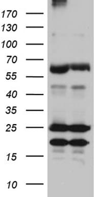 Monoclonal Mouse anti-Human ZFP57 Antibody (clone OTI1E2, Carrier-free, IHC, WB)