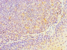 Polyclonal Rabbit anti-Human HOXA1 Antibody (aa75-205, IHC, WB)