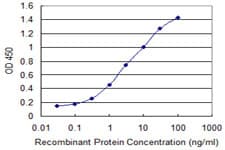 Monoclonal Mouse anti-Human CRYGC / CCL Antibody (clone 7C4, WB)