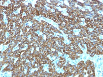 KRT76 / Keratin 76 Antibody (clone KRTH/1576R)
