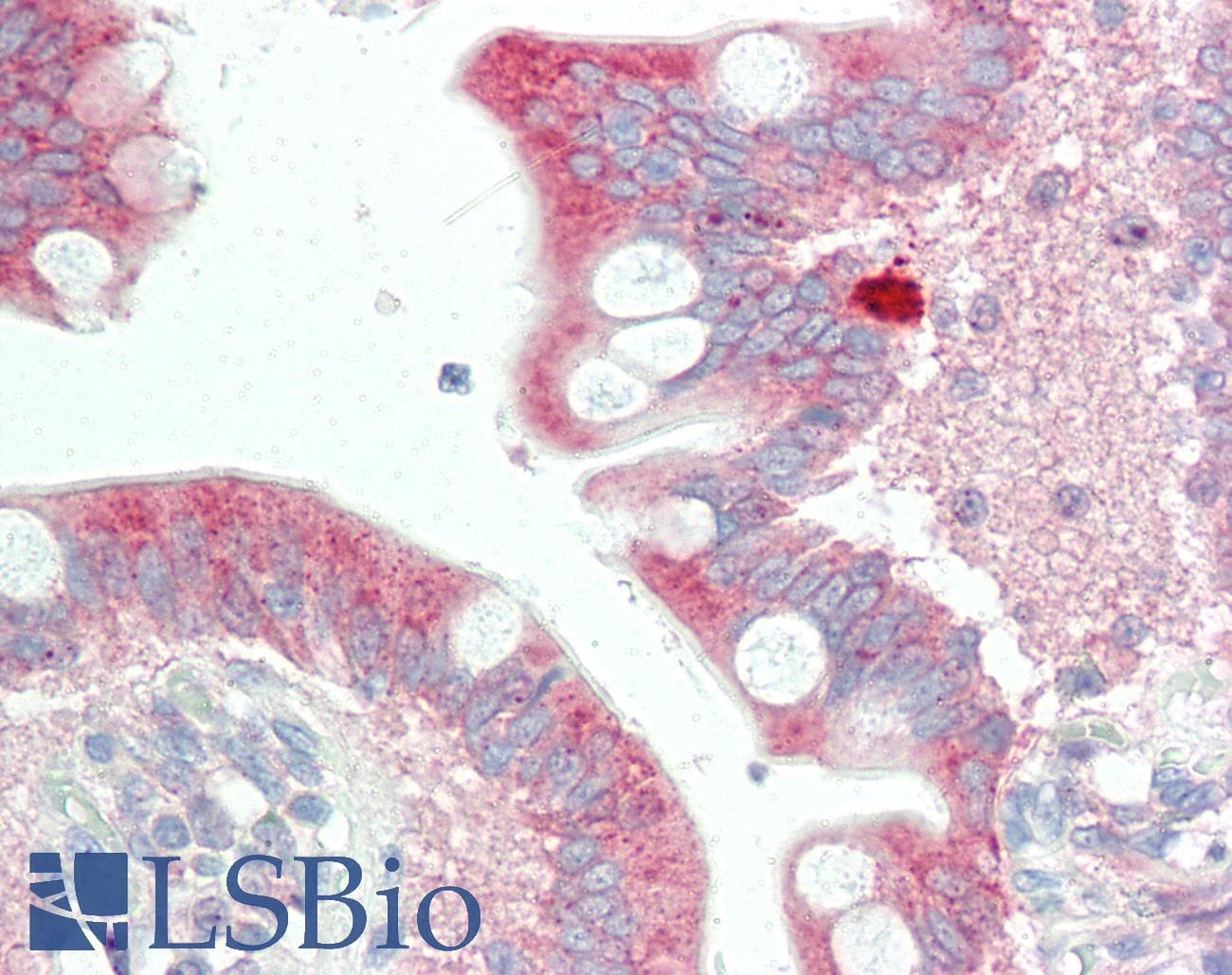 IHC-plus™ STIM2 Antibody