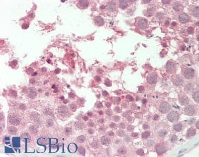 PSMA6 Antibody (aa26-75)