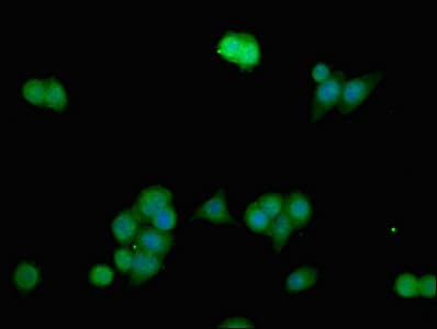 ANO1 / DOG1 / TMEM16A Antibody