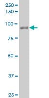 IHC-plus™ UBTF / UBF Antibody (clone 1A2)