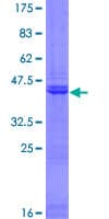 Human PHC3 Protein (Recombinant GST)