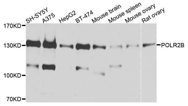 POLR2B / RPB2 Antibody