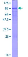 Human MDH1B Protein (Recombinant GST)