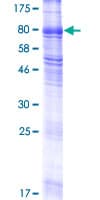 Human SLC38A4 / SNAT4 Protein (Recombinant GST)
