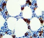 Monoclonal Mouse anti-Human CD71 / Transferrin Receptor Antibody (clone 10F11, IHC)