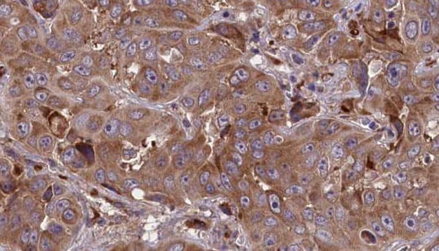 GPR1 Antibody
