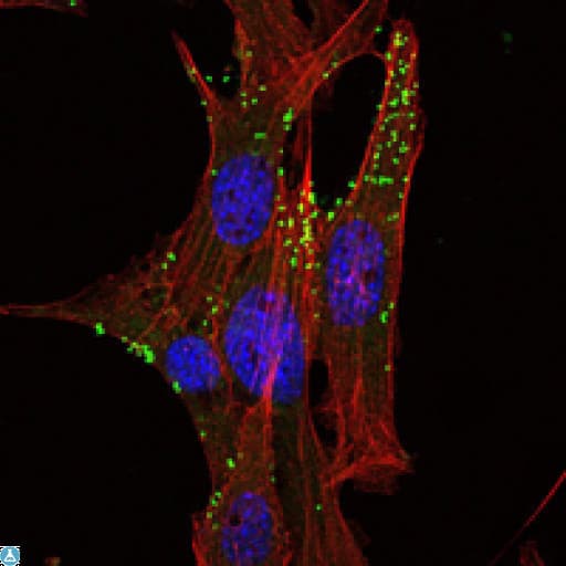 KLHL1 Antibody