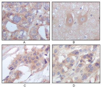 Monoclonal Mouse anti-Human STYK1 Antibody (clone 2H2F10, IHC, WB)