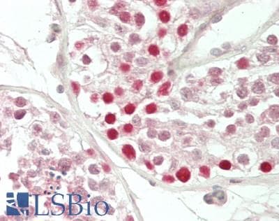 IHC-plus™ HIWI2 / PIWIL4 Antibody