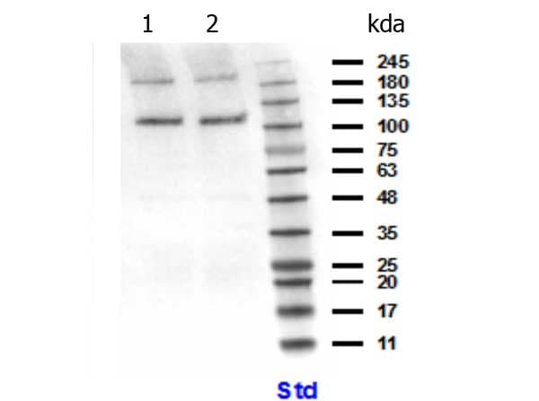 PIK3CB / PI3K Beta Antibody (N-Terminus)