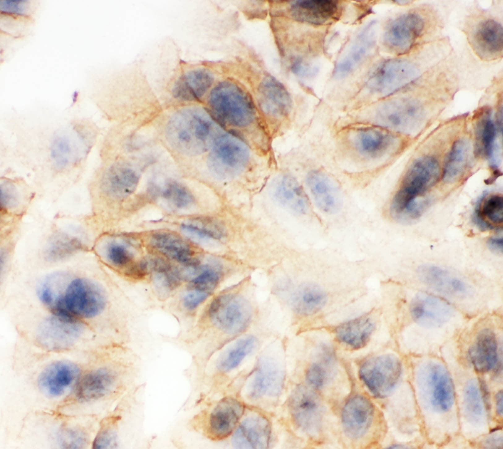 JUP/CTNNG/Junction Plakoglobin Antibody (aa556-745)