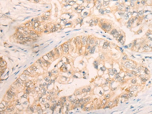 Polyclonal Rabbit anti-Human CD86 Antibody (IHC, WB)