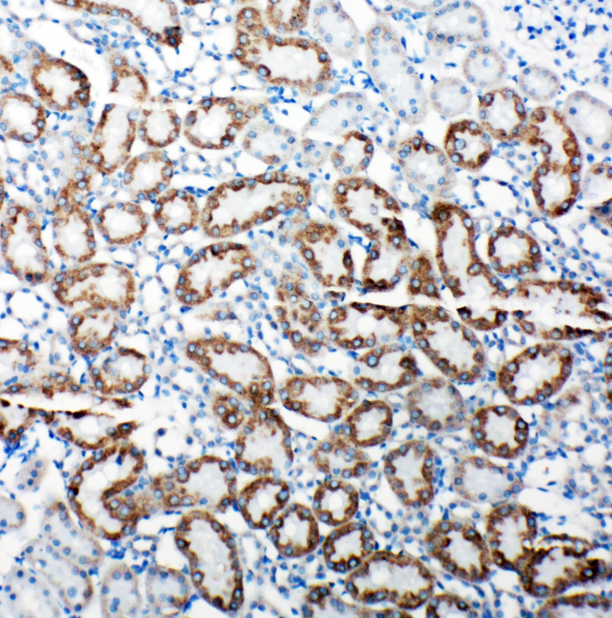 Polyclonal Rabbit anti-Human TRAM1 Antibody (aa314-331, IHC, WB)