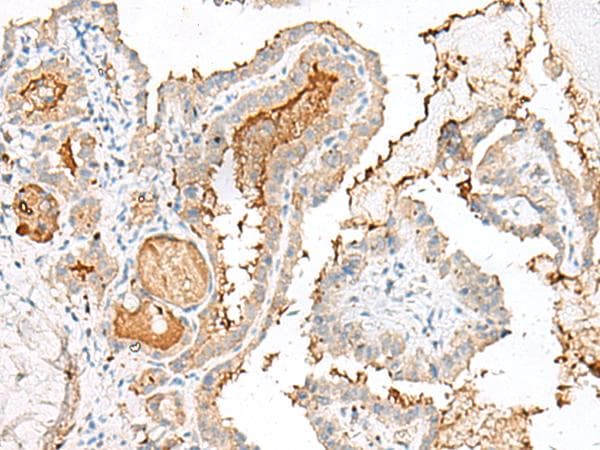 GARNL3 Antibody