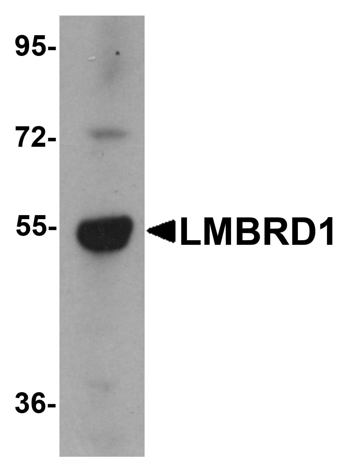 IHC-plus™ LMBRD1 Antibody