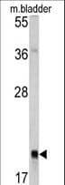 RAB13 Antibody (aa109-137)