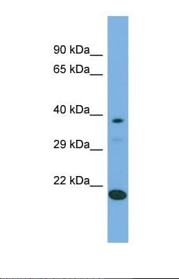 LIPT2 Antibody (aa151-200)