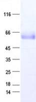 Human CD30 Protein (Recombinant DDK,C-terminus)