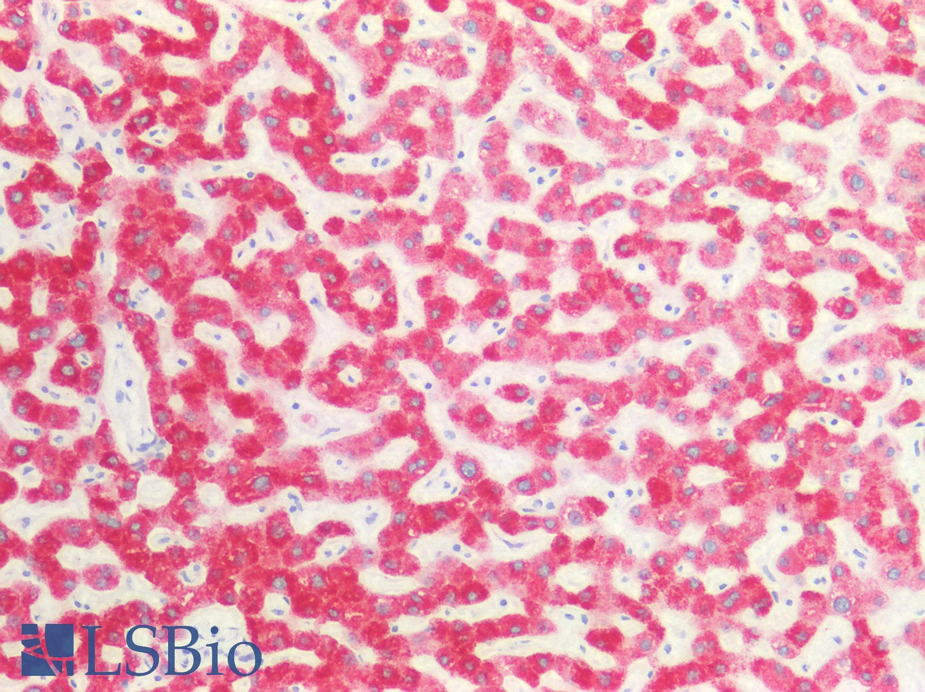 PathPlus™ CANX / Calnexin Antibody