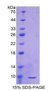 Rat T-Kininogen 1 Protein (Recombinant His)