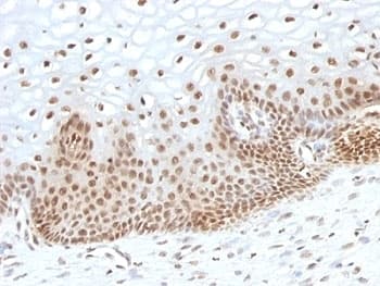 TNRC9 / TOX3 Antibody (aa200-400, clone TOX3/1123)