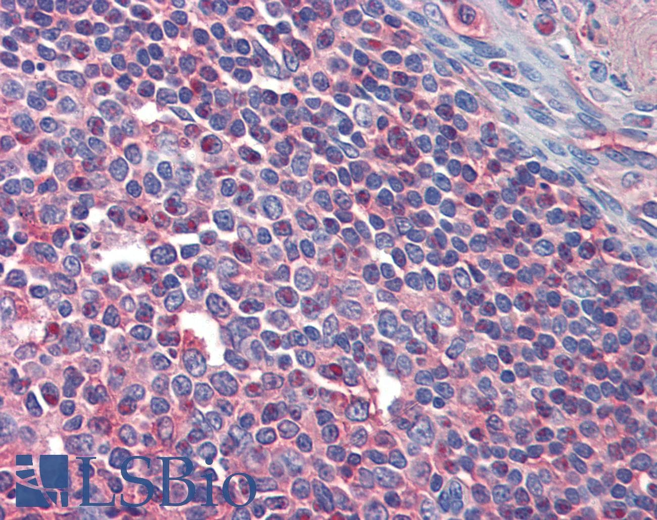 IHC-plus™ Polyclonal Rabbit anti-Human ITGA4 / VLA-4 / CD49d Antibody (IHC, WB)