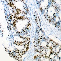 Polyclonal Rabbit anti-Human CDK2 Antibody (Internal, IHC, WB)