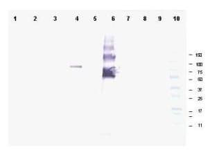 ANKRD26 Antibody (aa1-25)
