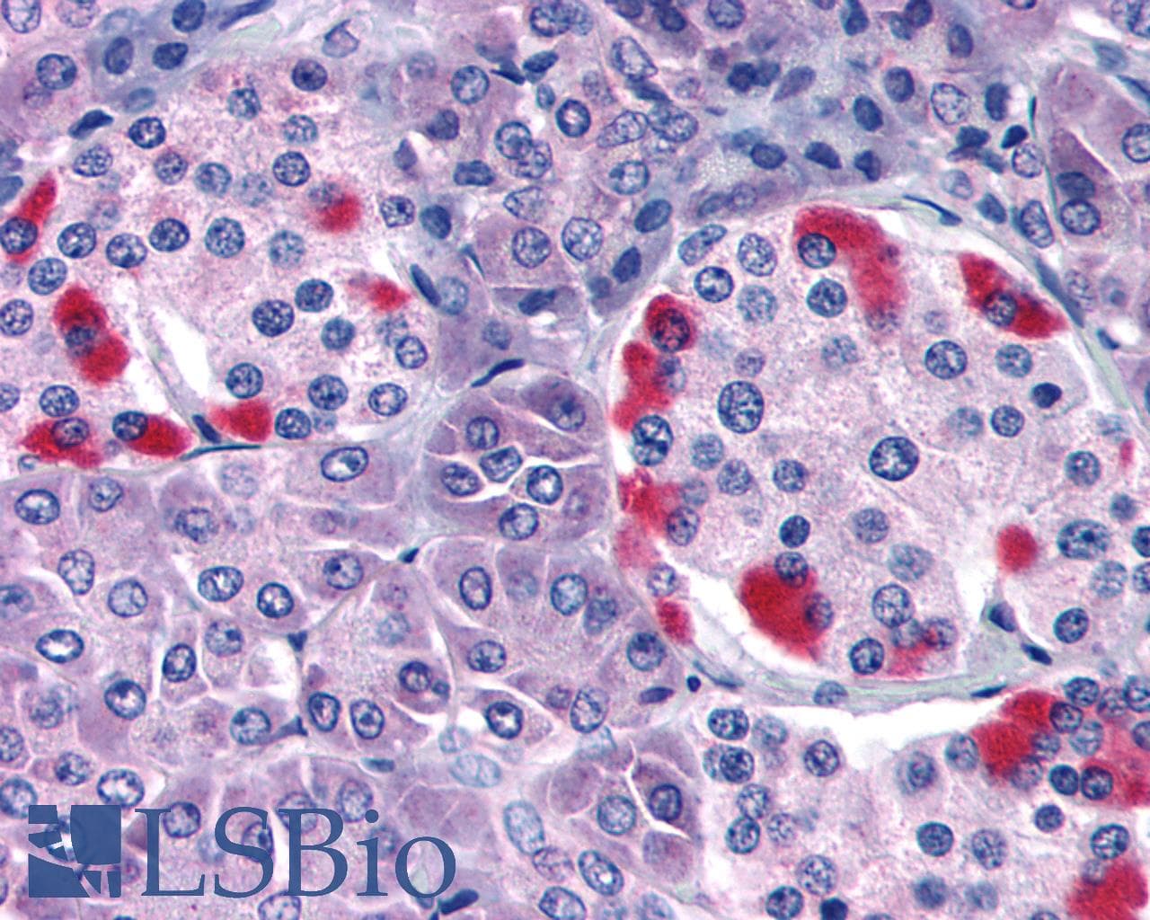 PathPlus™ Polyclonal Rabbit anti-Human GPRC5C Antibody (C-Terminus, IHC)