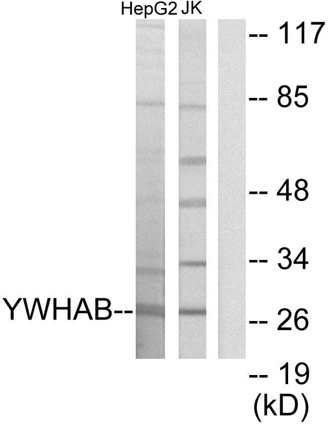 YWHAB / 14-3-3 Beta Antibody