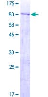 Human ZNF577 Protein (Recombinant GST)