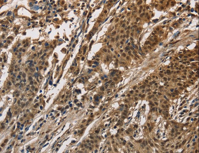 Polyclonal Rabbit anti-Human DIS / CCAR1 Antibody (IHC)