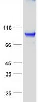 Human RAB6KIFL / KIF20A Protein (Recombinant Myc-DDK (Flag))