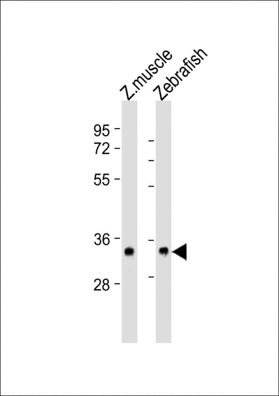 SIPR2 / S1P2 / EDG5 Antibody (aa39-73)