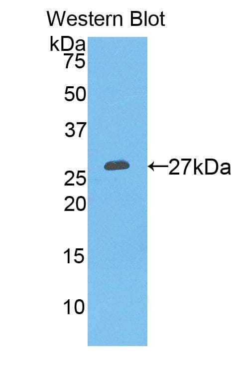 KLK3 / PSA Antibody (aa39-261, APC, Cy7)